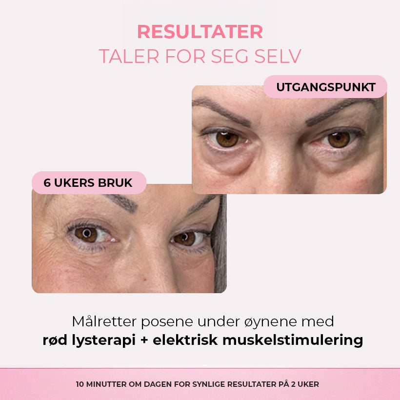 Revive Eyes® 2-i-1 rødt lysterapi + EMS for å fjerne poser under øynene