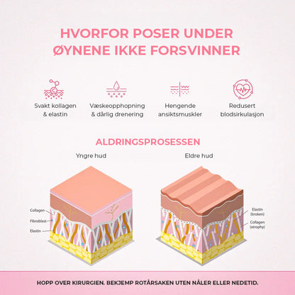 Revive Eyes® 2-i-1 rødt lysterapi + EMS for å fjerne poser under øynene